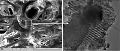 Brief review: Applications of nanocomposite in electrochemical sensor and drugs delivery